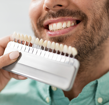 A man smiling with veneer samples held in front of his teeth.